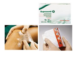 MEDICAZIONE STERILE IN FILM IN POLIURETANO TRASP. SUPRASORB F 5X7CM 10 PEZZI - farmacia187.it