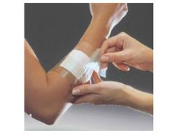 FILM ADESIVO IN POLIURETANO IN ROTOLO TRASPARENTE IMPERMEABILE PER FISSAGGIO DI MEDICAZIONI E CATETERI 10X1000CM 1 PEZZO - farmacia187.it